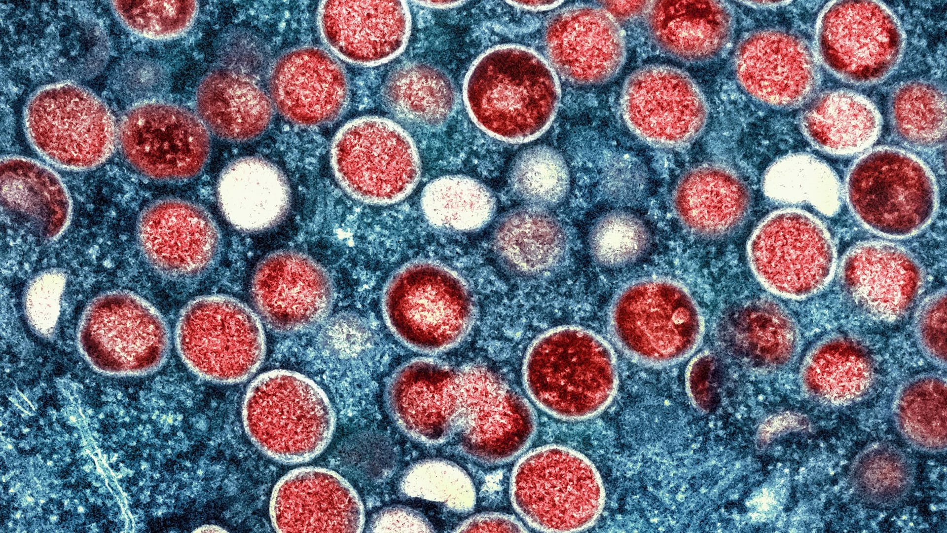 Mikroskopaufnahme von Mpox-Partikeln (rot) in einer infizierten Zelle (blau): Das Virus wird vor allem durch engen körperlichen Kontakt übertragen.