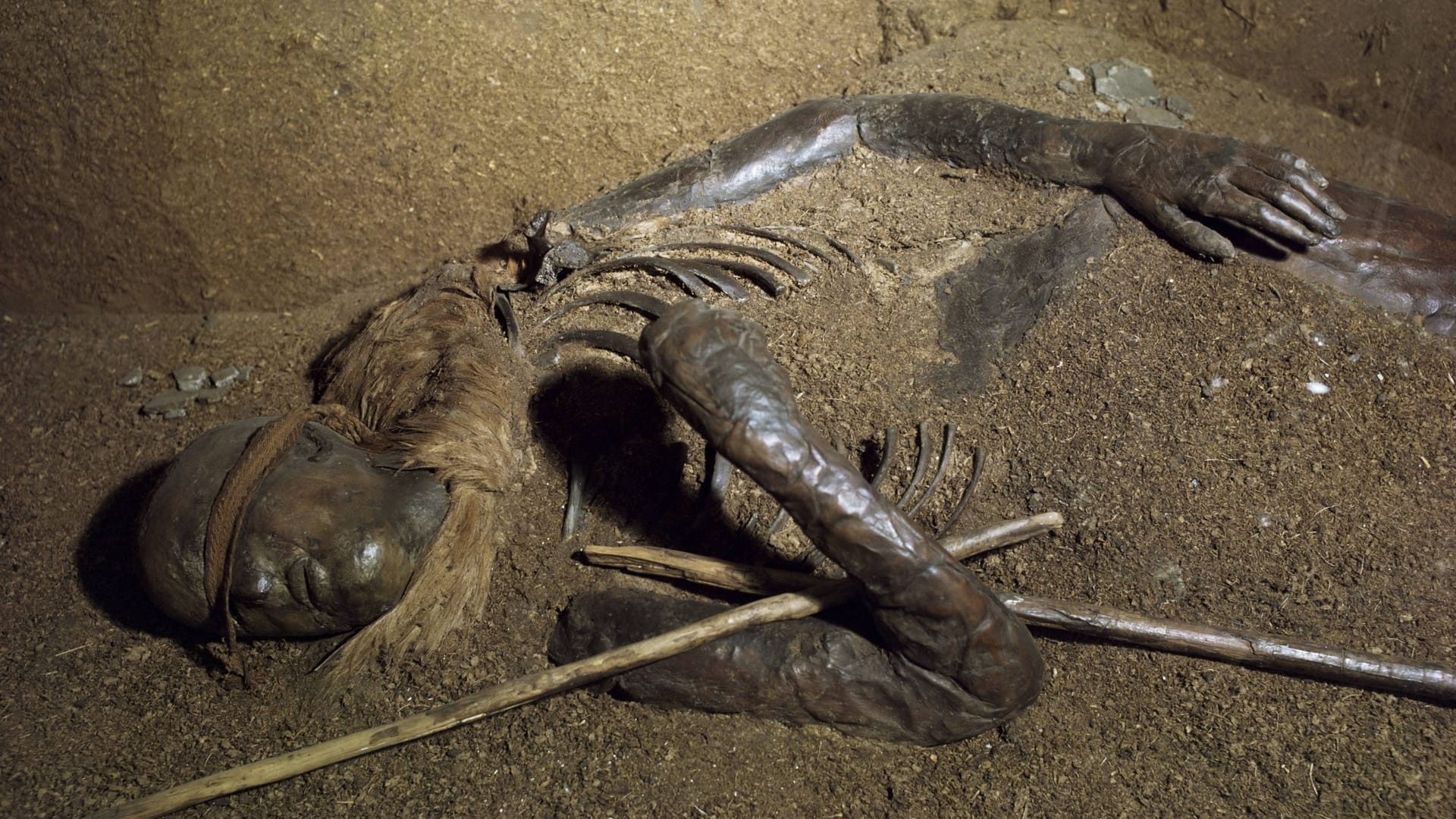 "Das Kind von Windeby": Die gut erhaltene Moorleiche ist in einer Dauerausstellung zu sehen.