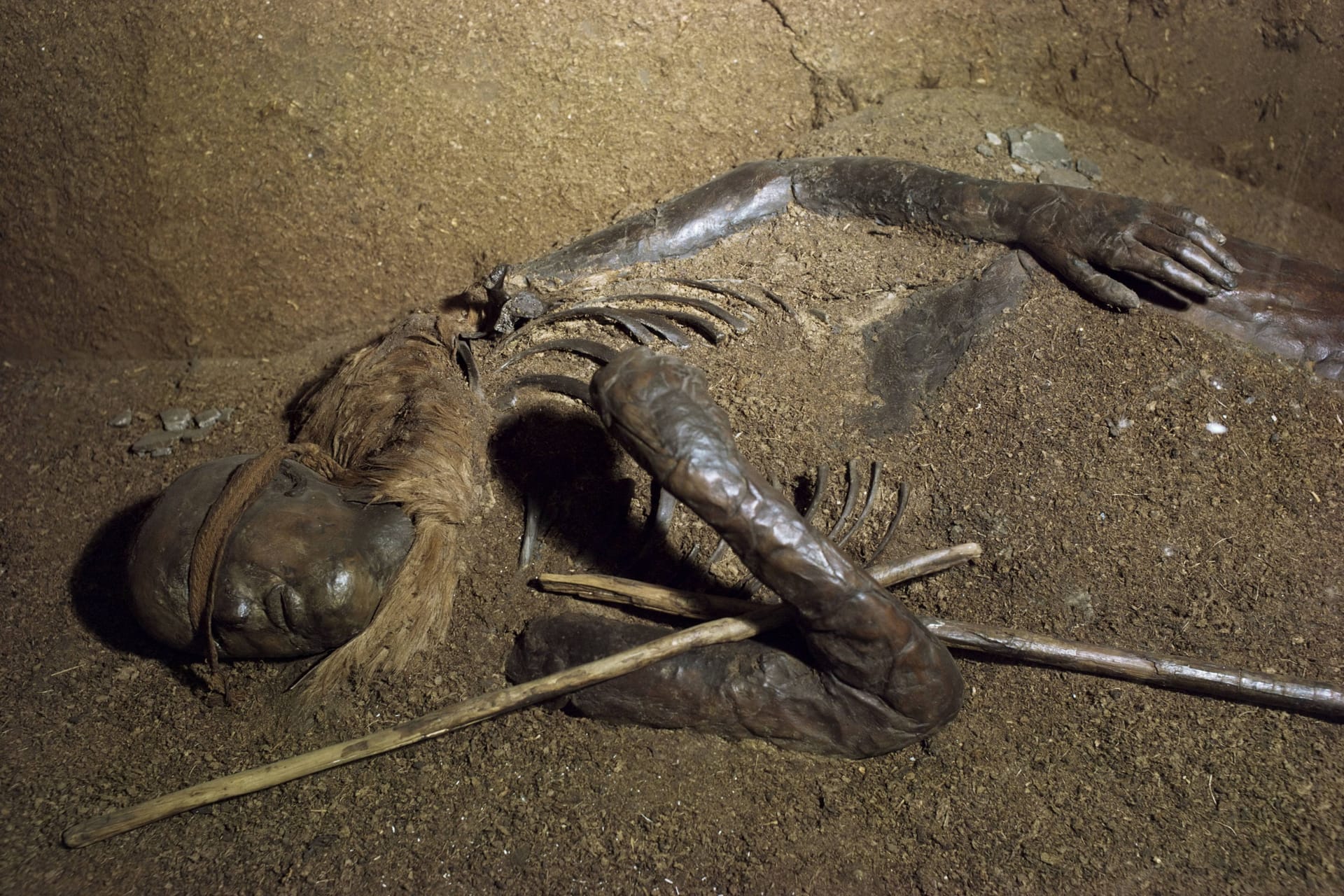 "Das Kind von Windeby": Die gut erhaltene Moorleiche ist in einer Dauerausstellung zu sehen.