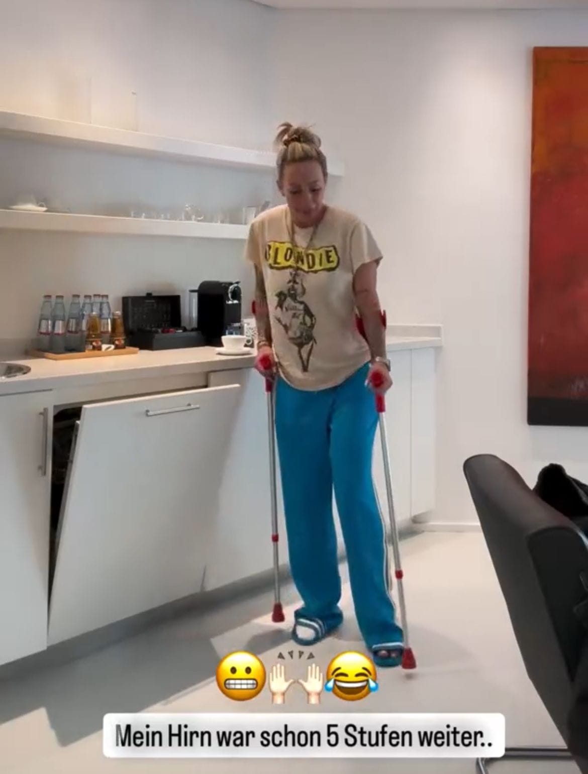 Cora Schumacher zeigt sich verletzt auf Instagram.