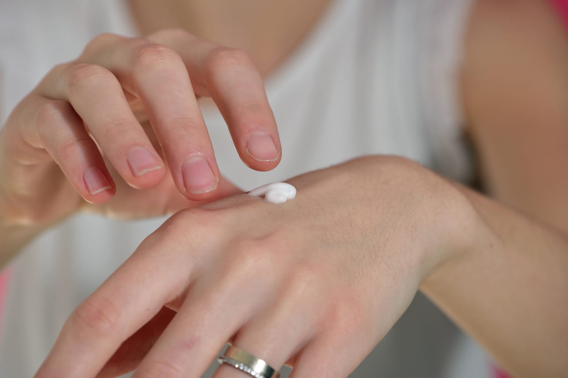 Eine Frau cremt sich die Hände ein (Symbolbild): Bei dm wird ein Handserum zurückgerufen.