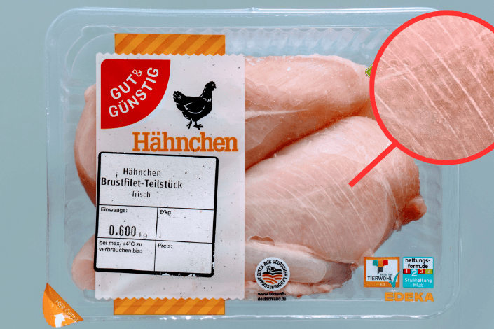 Eine der Stichproben: Bei den weißen Streifen handelt es sich um Symptome einer Muskelkrankheit.