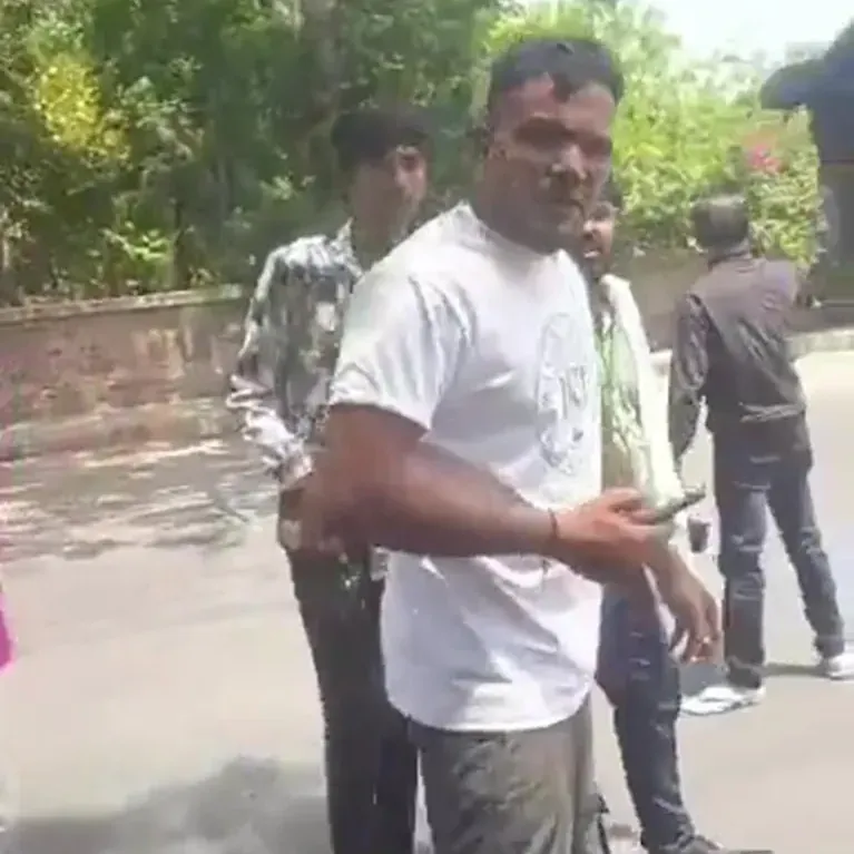 Blut im Gesicht: Vishwash Kumar Ramesh soll den Flugabsturz in Indien überlebt haben.