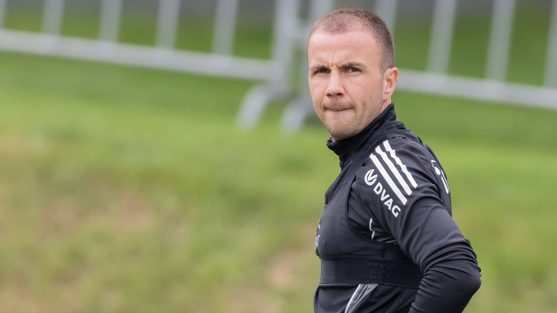 Mario Götze: Er hat sich einer Haar-OP unterzogen.