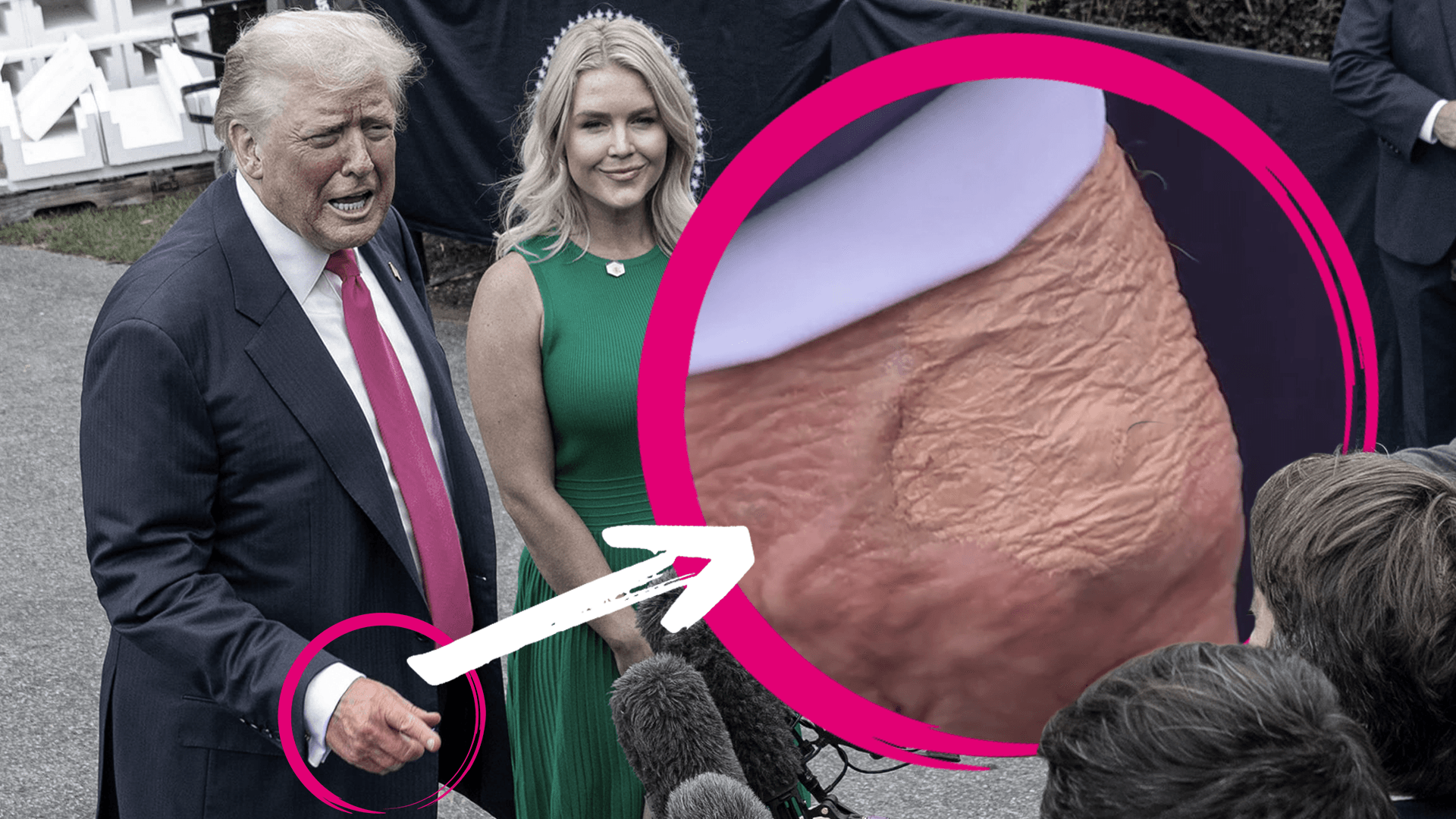 Donald Trump: Fleck an der Hand des US-Präsidenten sorgt für Spekulationen
