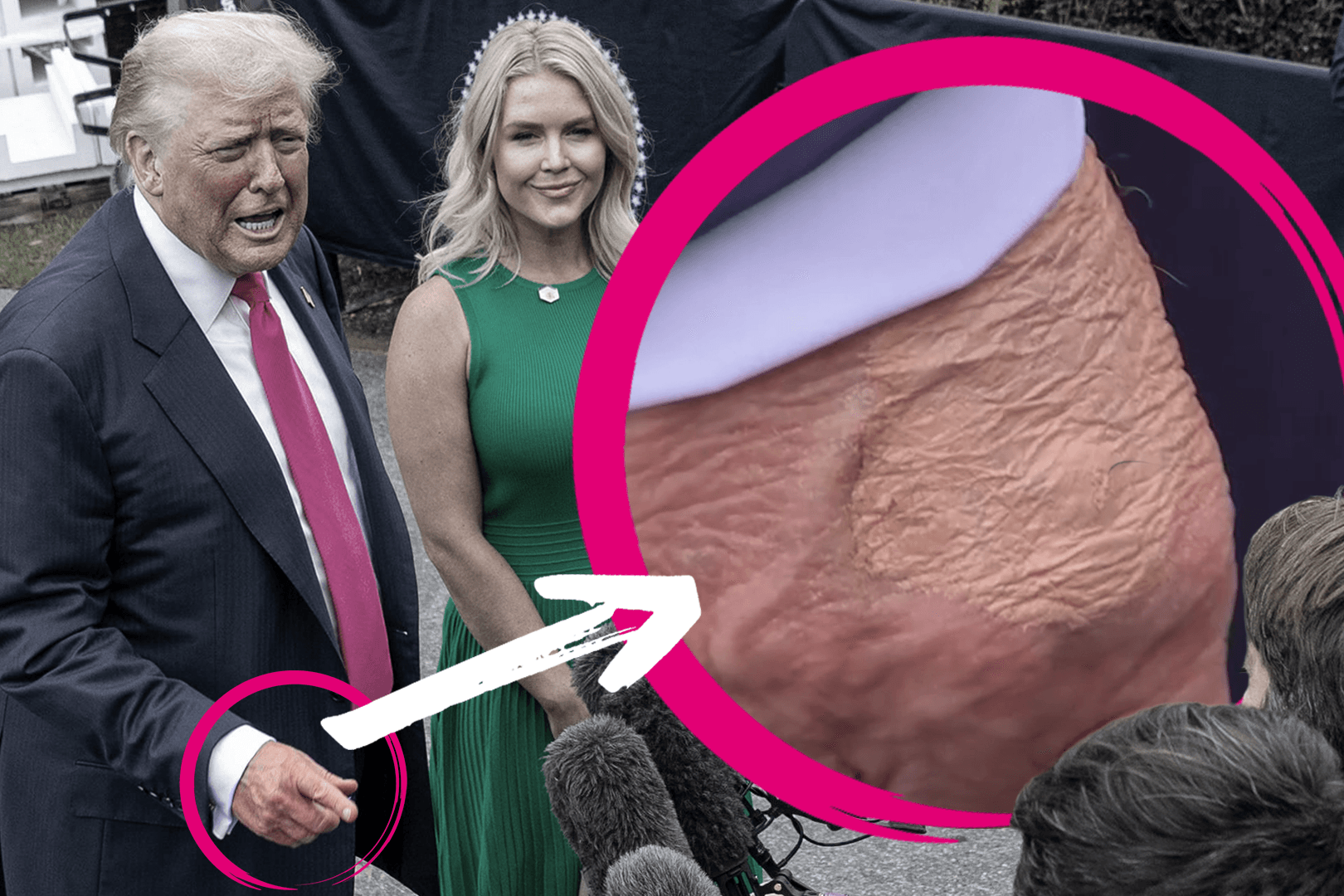 Donald Trump: Fleck an der Hand des US-Präsidenten sorgt für Spekulationen