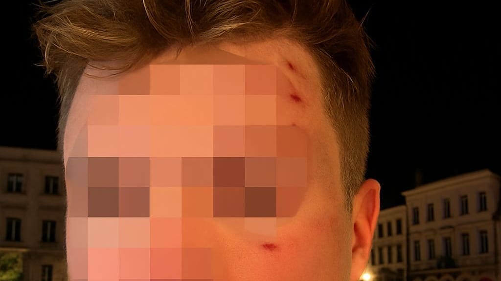 Foto zeigt CDU-Mitglied nach der Bar-Attacke in Brüssel: Platzwunden und Gehirnerschütterung.