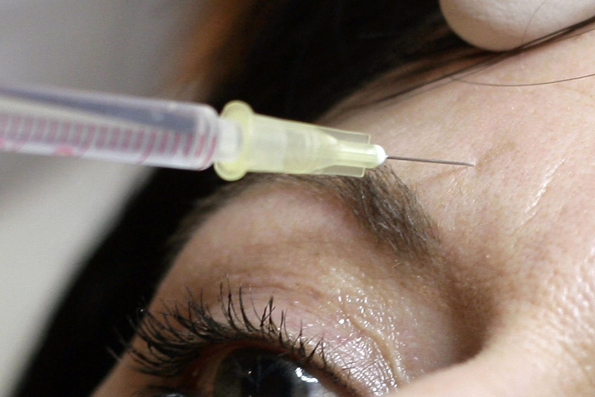 Botox