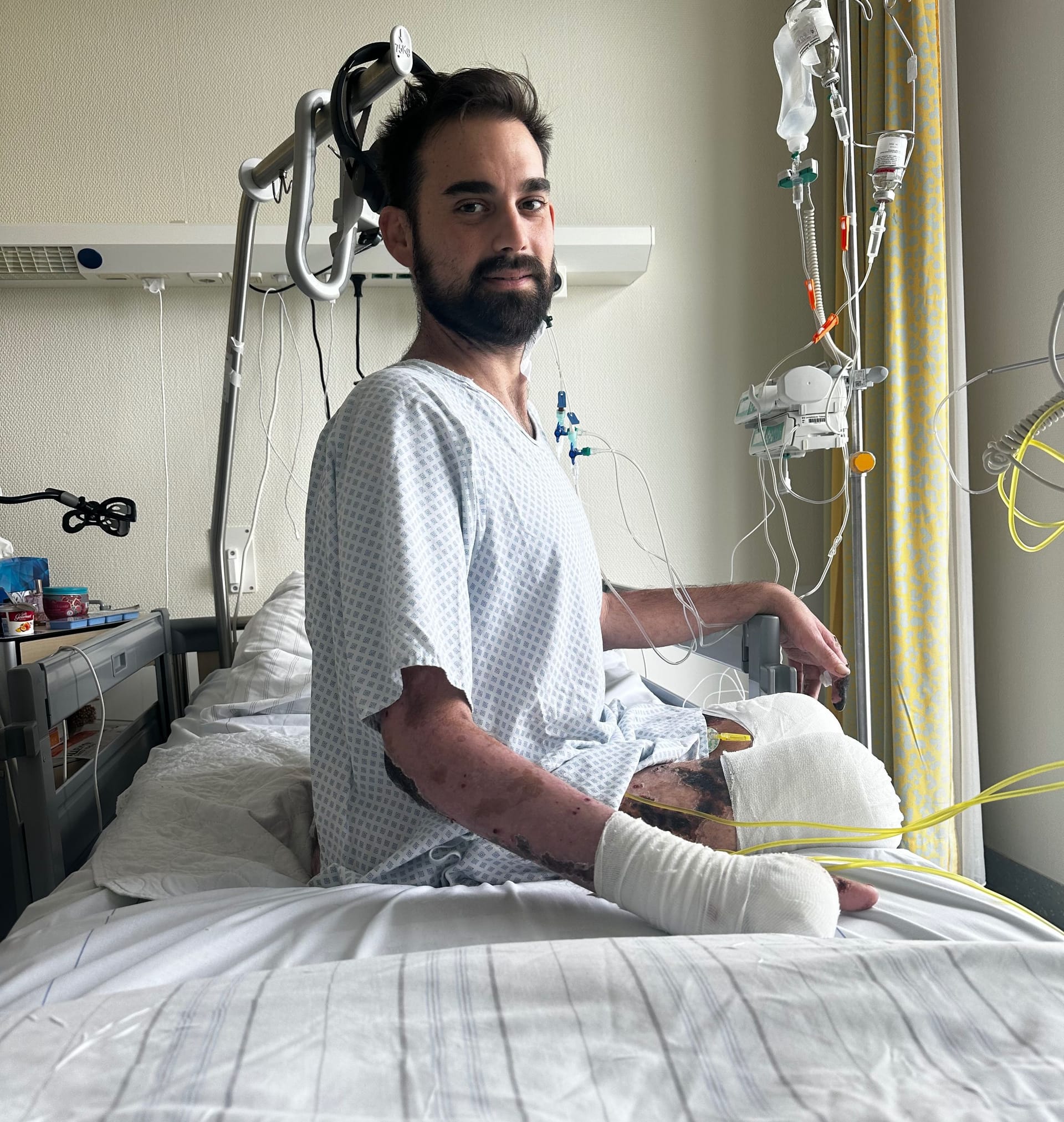 Alessandro L.: Er verbrachte viele Monate im Krankenhaus und in der Reha.