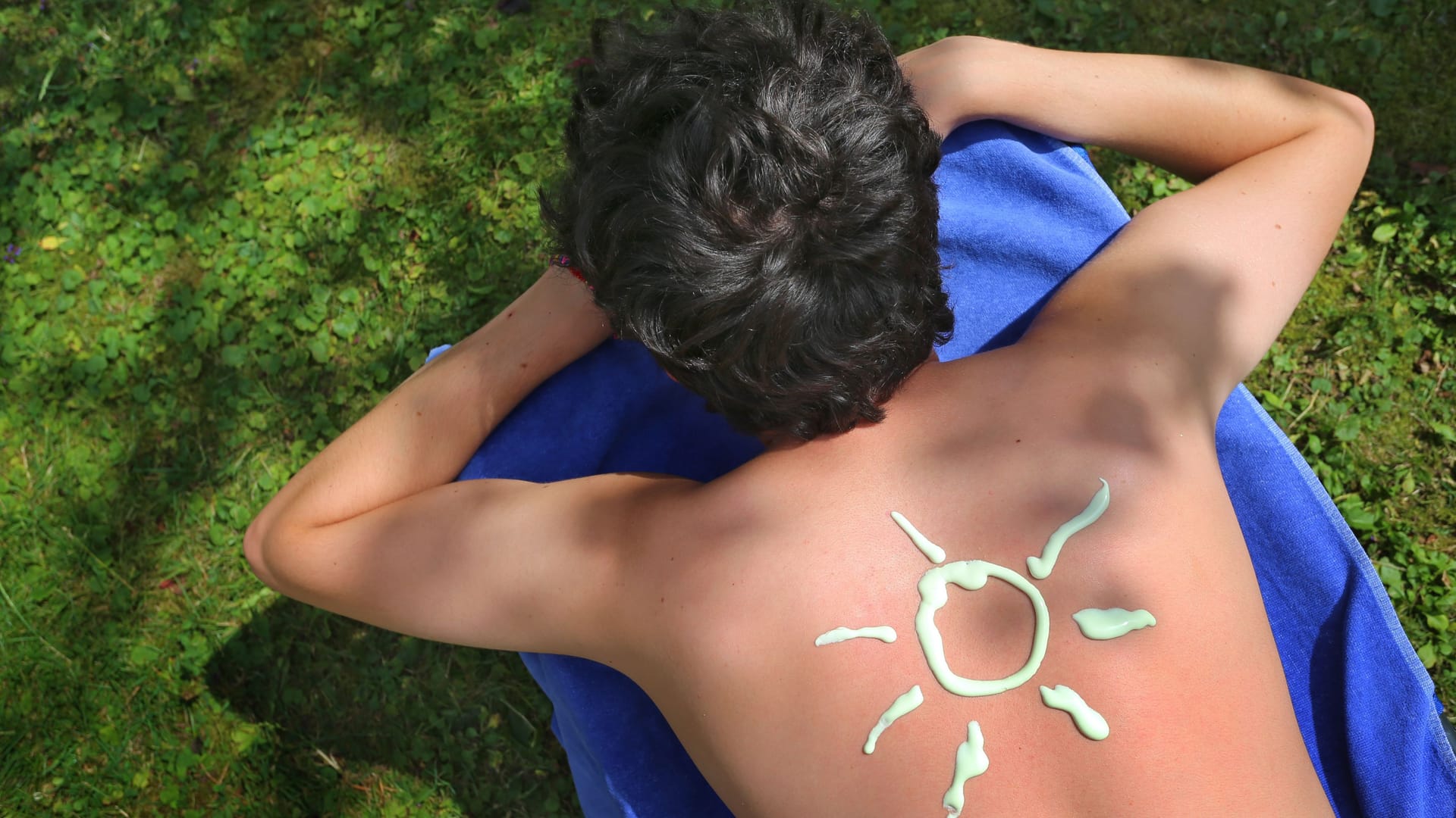 Eine Sonnencreme-Sonne ist auf einem Rücken zu sehen (Symbolbild): Hohe UV-Belastungen und Sonnenbrände erhöhen das Hautkrebsrisiko.