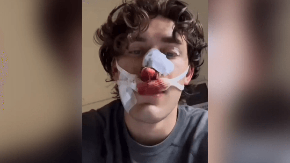 Dresden: US-Amerikaner in Straßenbahn attackiert – Opfer fassungslos