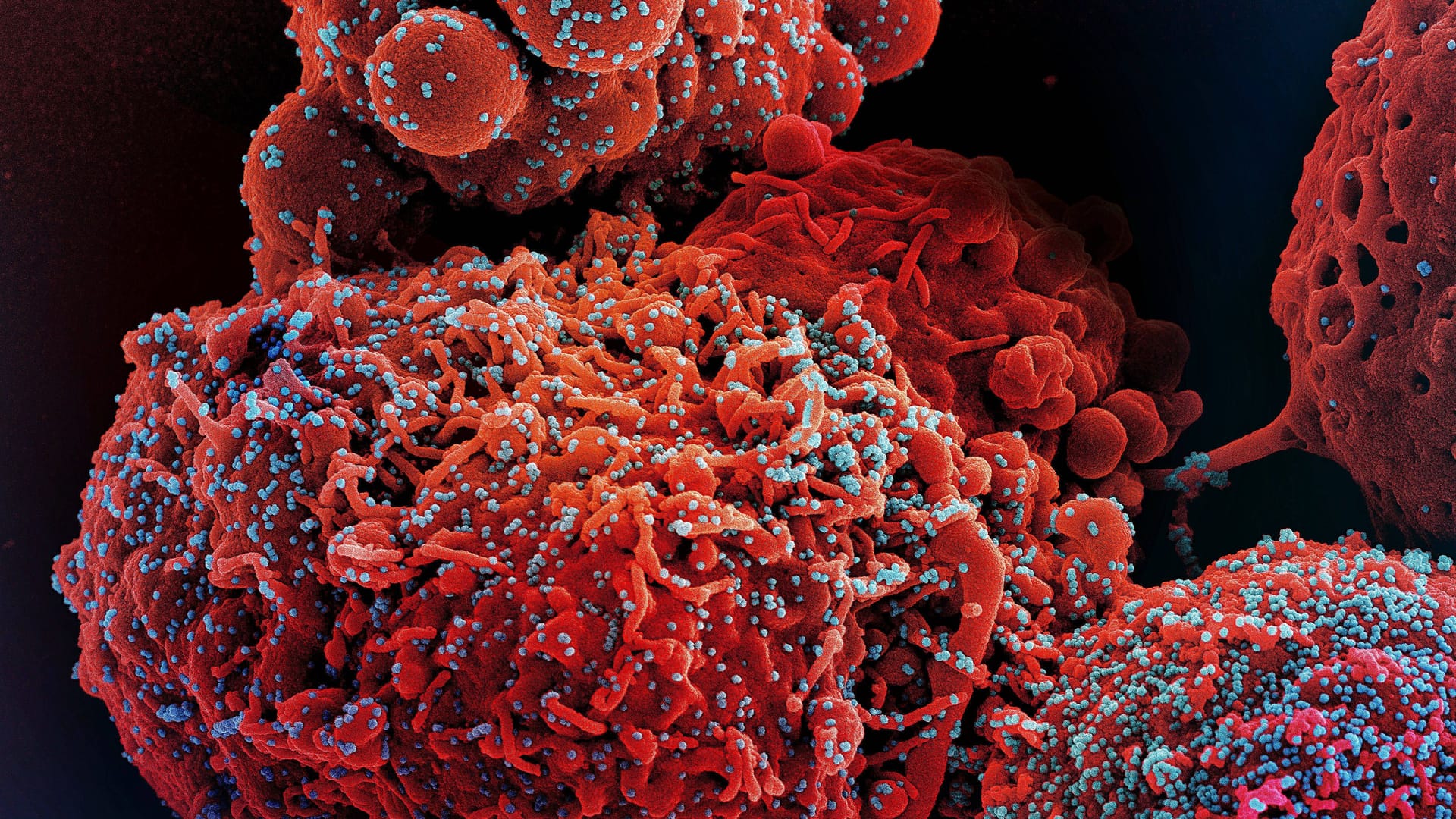 Das Coronavirus auf einer befallenen Zelle: In der zweiten Oktoberwoche sind mehr Covid-19-Infektionen in Köln gemeldet worden als in jeder anderen Woche seit Jahresbeginn.