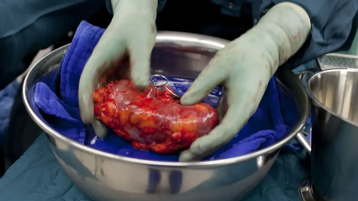 Nieren-Transplantation: Forscher entwickeln universelle Spenderniere