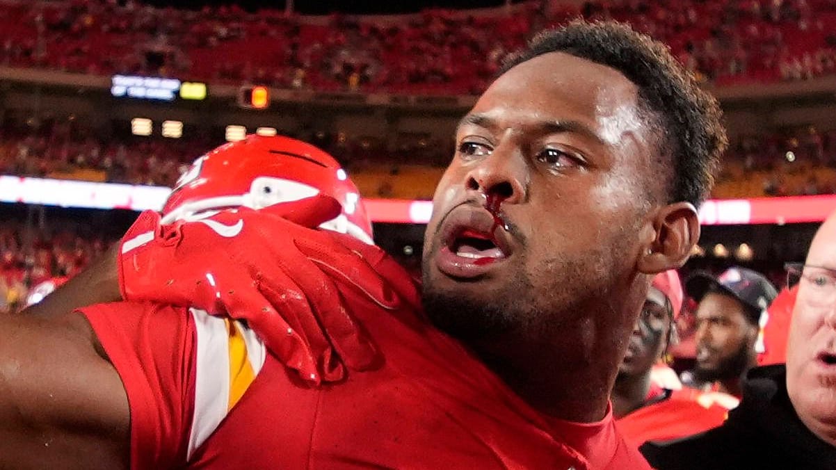 Juju Smith-Schuster mit blutiger Nase: Er wurde nach dem Spiel attackiert. Juju Smith-Schuster mit blutiger Nase: Er wurde nach dem Spiel attackiert.