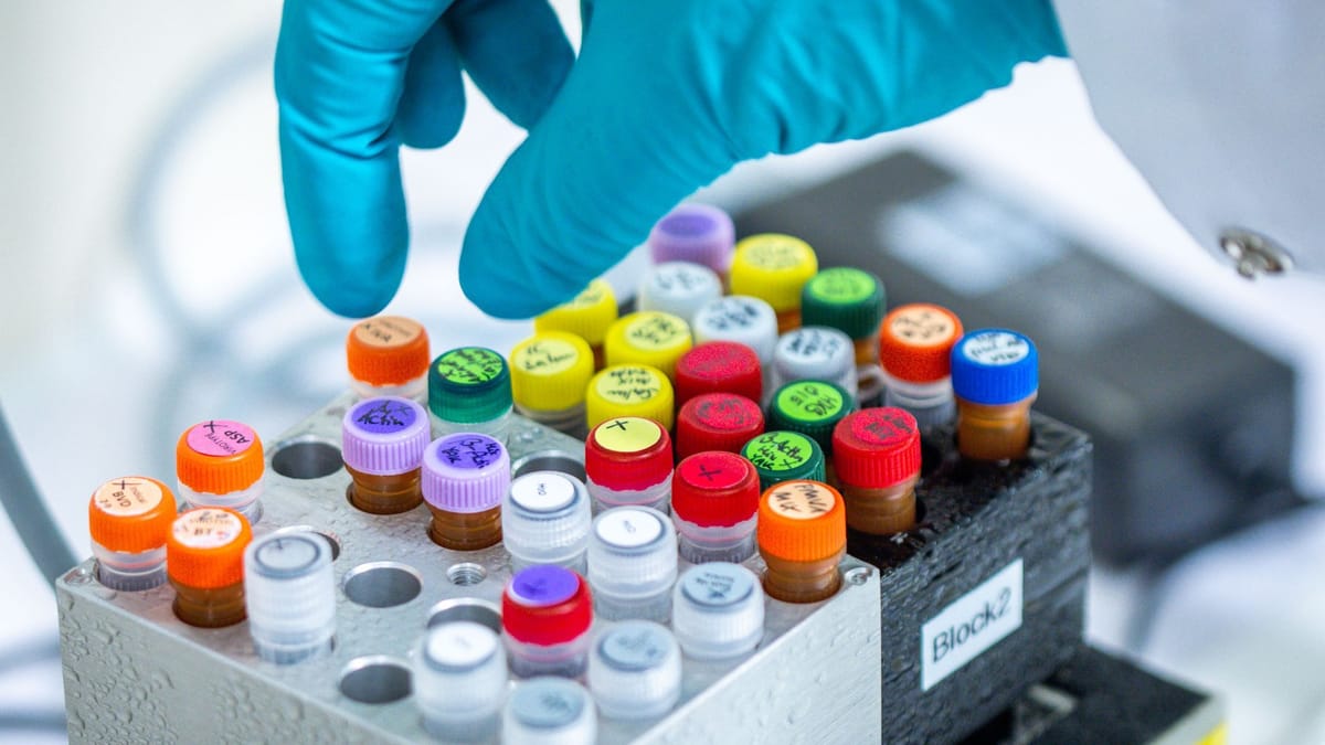 V Nemčiji zaradi izbruha EHEC umrli dve osebi