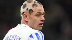 Im Leoparden-Look: BVB-Star trägt neue Frisur