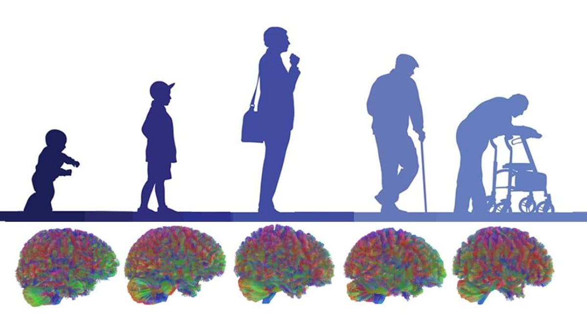 Hirn-Forschung: Diese fünf Phasen erlebt unser Gehirn im Leben