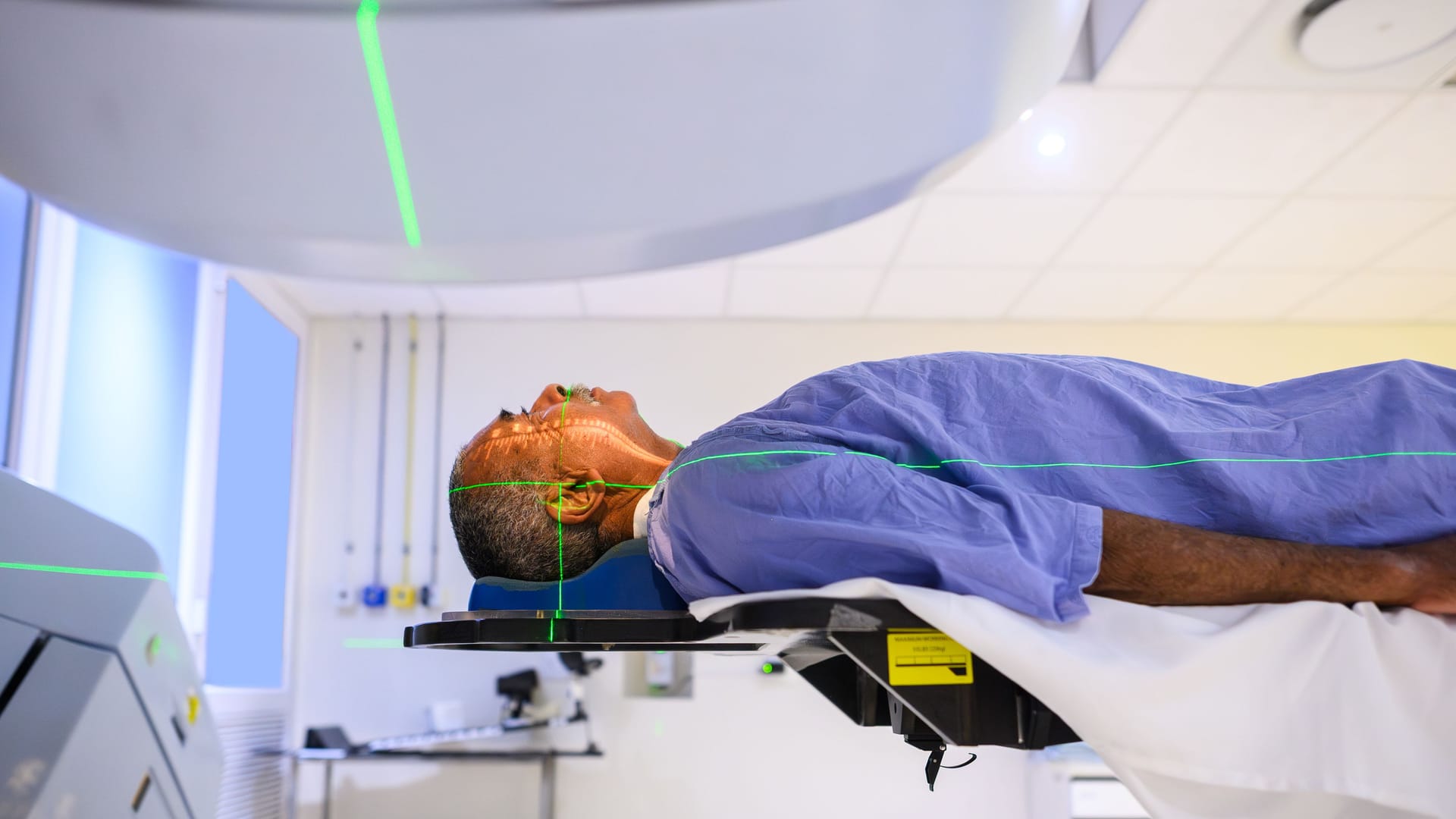 Strahlentherapie bei Krebs: Durch die gezielte Bestrahlung treten Nebenwirkungen meist lokal auf.